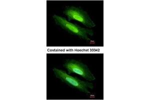 ICC/IF Image Immunofluorescence analysis of methanol-fixed HeLa, using PDE6D, antibody at 1:500 dilution.