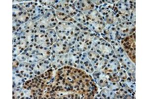 Immunohistochemistry (IHC) image for anti-Induced Myeloid Leukemia Cell Differentiation Protein Mcl-1 (MCL1) antibody (ABIN1499337) (MCL-1 anticorps)
