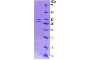 SDS-PAGE analysis of Human Nerve Growth Factor Protein. (Nerve Growth Factor Protein (NGF))