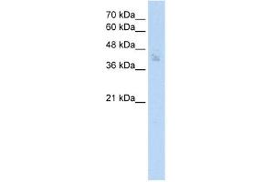 WB Suggested Anti-SPDEF Antibody Titration: 2. (SPDEF/PSE anticorps  (N-Term))