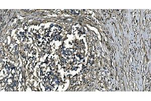 IHC analysis of GNG7 using anti-GNG7 antibody (ABIN7600508). (GNG7 anticorps  (AA 2-57))