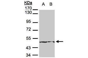 WB Image Sample(30 μg of whole cell lysate) A:H1299 B:Hep G2, 7.