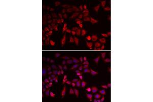 Immunofluorescence analysis of MCF-7 cells using PYGL antibody. (PYGL anticorps  (AA 1-280))