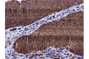 Image no. 7 for anti-Kelch-Like ECH-Associated Protein 1 (KEAP1) antibody (ABIN1499016)