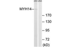 Western blot analysis of extracts from 293 cells, using MYH14 Antibody. (Myosin anticorps  (AA 1051-1100))