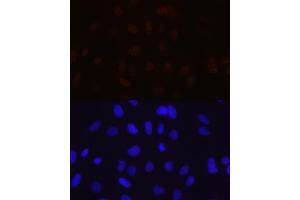 anti-Muscleblind-like Protein 1 (MBNL1) antibody