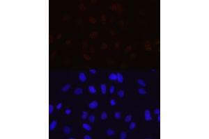 Immunofluorescence analysis of U-2 OS cells using MBNL1 Rabbit mAb (ABIN7268704) at dilution of 1:100 (40x lens). (MBNL1 anticorps)