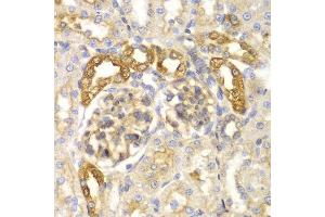 Immunohistochemistry of paraffin-embedded rat kidney using PYCARD antibody at dilution of 1:100 (400x lens). (STS anticorps)