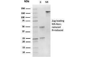 SDS-PAGE Analysis Purified p27 MAb (DCS-72. (CDKN1B anticorps)