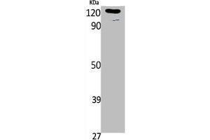 Western Blot analysis of K562, cells using Phospho-Ob-R (Y1141) Polyclonal Antibody (Leptin Receptor anticorps  (pTyr1141))