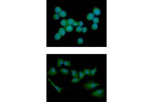 ICC/IF analysis of NBL1 in Jurkat cells line, stained with DAPI (Blue) for nucleus staining and monoclonal anti-human NBL1 antibody (1:100) with goat anti-mouse IgG-Alexa fluor 488 conjugate (Green). (NBL1 anticorps)