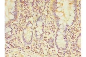 Immunohistochemistry of paraffin-embedded human small intestine tissue using ABIN7172078 at dilution of 1:100 (TARS2 anticorps  (AA 369-718))