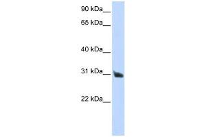 RNASE9 antibody used at 1 ug/ml to detect target protein.