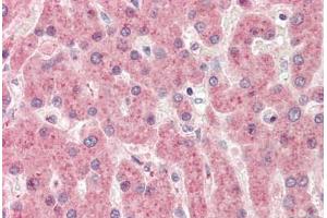 Human, Liver: Formalin-Fixed Paraffin-Embedded (FFPE)