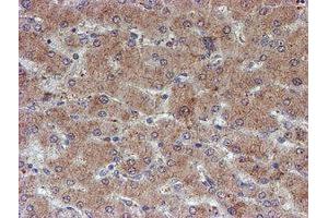 Image no. 14 for anti-ATR Interacting Protein (ATRIP) (AA 42-309) antibody (ABIN1491507)