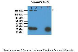 Lanes:   1: 10ug SUR1 KO mouse ventricle lysate, 2: 10ug WT mouse ventricle lysate, 3: 0. (ABCC9 anticorps  (Middle Region))