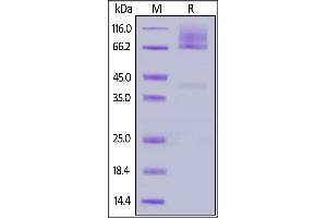 Cynomolgus Glypican 3, His Tag on  under reducing (R) condition.