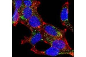 Confocal immunofluorescence analysis of LNCaP cells using AMACR mouse mAb (green).