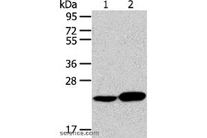 Western blot analysis of Human liver cancer tissue and hela cell, using RAB8A Polyclonal Antibody at dilution of 1:100 (RAB8A anticorps)