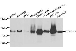 Western blot analysis of extracts of various cell lines, using DYNC1I1 antibody. (DYNC1I1 anticorps  (AA 1-220))