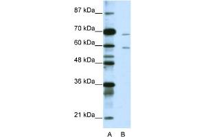 WB Suggested Anti-FOXA2 Antibody Titration:  1. (FOXA2 anticorps  (N-Term))