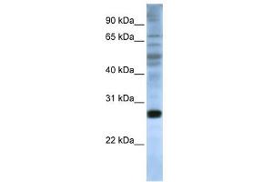 EIF4E antibody used at 1 ug/ml to detect target protein. (EIF4E anticorps  (C-Term))