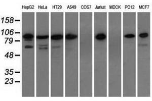 Image no. 3 for anti-Transforming, Acidic Coiled-Coil Containing Protein 3 (TACC3) antibody (ABIN1498100) (TACC3 anticorps)