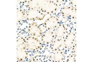 Immunohistochemistry of paraffin embedded rat kidney using NPEPL1 (ABIN7073185) at dilution of 1:100 (400x lens) (BIVM anticorps)