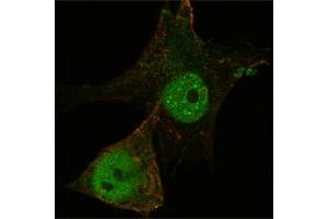 Confocal immunofluorescence analysis of PANC-1 cells using FOXP3 mouse mAb (green). (FOXP3 anticorps)