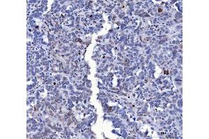 IHC analysis of Lamin A+C/LMNA using anti-Lamin A+C/LMNA antibody (ABIN7601843). (Lamin A/C anticorps  (AA 481-646))