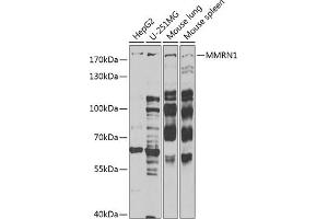 Western blot analysis of extracts of various cell lines, using MMRN1 Antibody (ABIN6129053, ABIN6143926, ABIN6143927 and ABIN6222357) at 1:1000 dilution. (Multimerin 1 anticorps  (AA 949-1228))