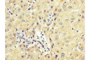 IHC image of ABIN7163773 diluted at 1:200 and staining in paraffin-embedded human liver tissue performed on a Leica BondTM system.