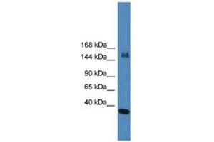 Image no. 1 for anti-Lysine (K)-Specific Demethylase 6A (KDM6A) (N-Term) antibody (ABIN6745346) (KDM6A anticorps  (N-Term))
