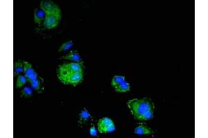 Immunofluorescent analysis of MCF-7 cells using ABIN7151778 at dilution of 1:100 and Alexa Fluor 488-congugated AffiniPure Goat Anti-Rabbit IgG(H+L)