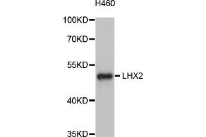 Western blot analysis of extracts of H460 cells, using LHX2 antibody (ABIN5998134) at 1/1000 dilution. (LHX2 anticorps)