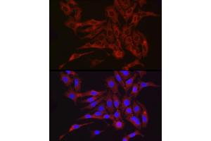 Immunofluorescence analysis of  cells using Furin Rabbit pAb (ABIN6127933, ABIN6140815, ABIN6140817 and ABIN6223322) at dilution of 1:150 (40x lens).
