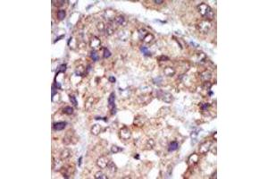 Image no. 2 for anti-V-Yes-1 Yamaguchi Sarcoma Viral Related Oncogene Homolog (LYN) (N-Term) antibody (ABIN359987) (LYN anticorps  (N-Term))