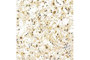 Immunohistochemistry of paraffin embedded mouse placenta using Skar (ABIN7074970) at dilution of 1:900 (400x lens) (p46 anticorps)