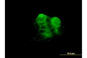 Immunofluorescence of monoclonal antibody to RDX on A-431 cell.