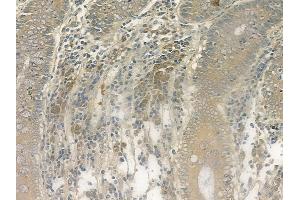 ABIN6264244 and ABIN6269328 at 1/100 staining human normal colon tissue by IHC-P. (PKC delta anticorps  (C-Term))