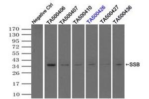Image no. 2 for anti-Sjogren Syndrome Antigen B (SSB) antibody (ABIN1501146)