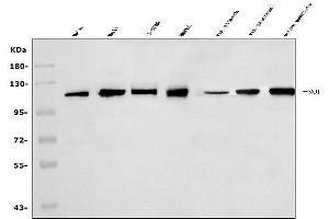 Western blot analysis of SND1 using anti-SND1 antibody (ABIN7600527).