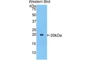 Western blot analysis of the recombinant protein. (SERPINA1 anticorps  (AA 27-181))