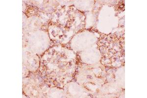 Anti-P Glycoprotein Picoband antibody,  IHC(F): Rat Kidney Tissue
