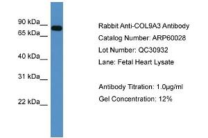 WB Suggested Anti-COL9A3  Antibody Titration: 0. (COL9A3 anticorps  (C-Term))