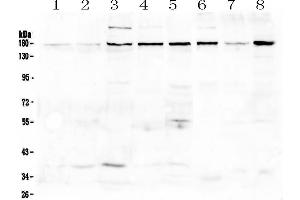 Western blot analysis of EEA1 using anti-EEA1 antibody . (EEA1 anticorps)