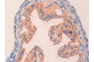 Detection of CA5B in Mouse Ovary Tissue using Polyclonal Antibody to Carbonic Anhydrase VB, Mitochondrial (CA5B)