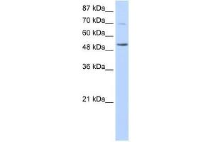 IKZF3 antibody used at 0.