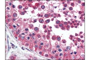Image no. 1 for anti-Hepatitis A Virus Cellular Receptor 1 (HAVCR1) (AA 200-300) antibody (ABIN372415)