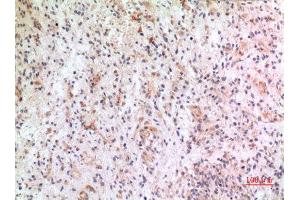 Immunohistochemistry (IHC) analysis of paraffin-embedded Human Brain, antibody was diluted at 1:100. (CX3CL1 anticorps  (Internal Region))